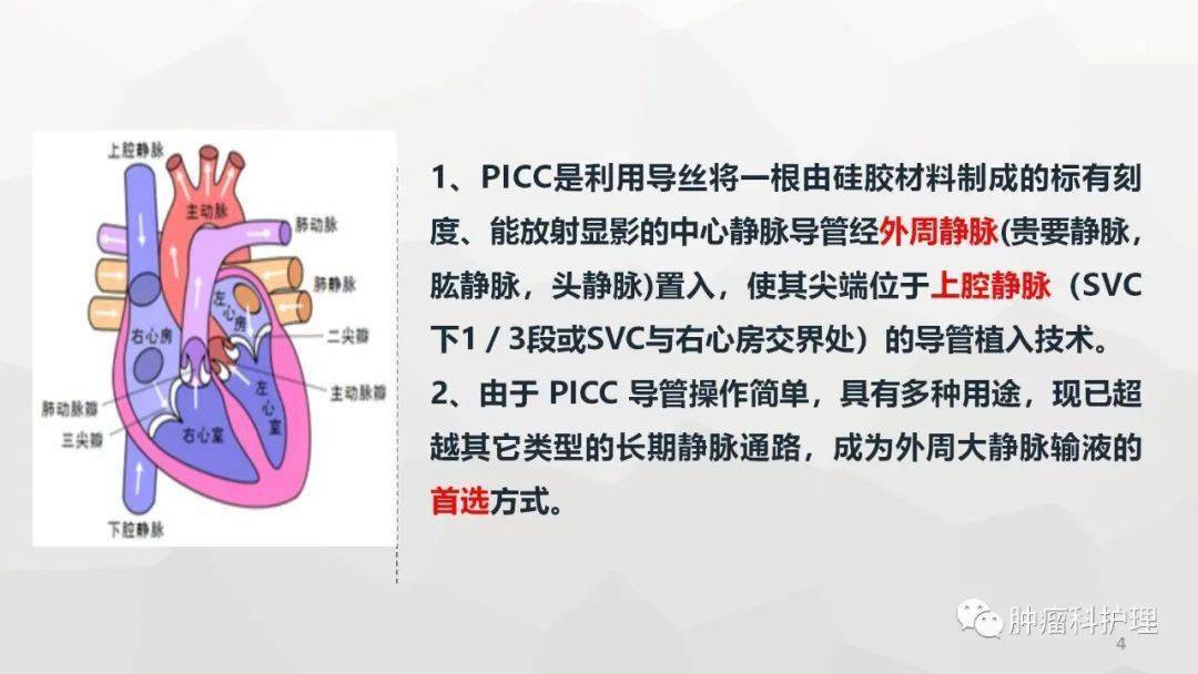 svc是什么意思(SVG和SVC的区别和用途)
