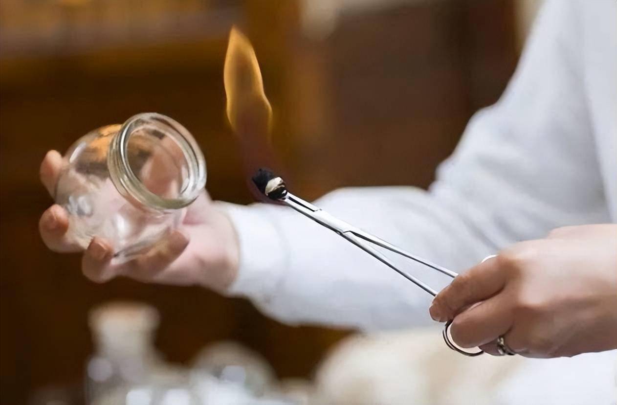 拔火罐吸出来的瘀血是体内的毒素吗告诉你真相看完涨知识了