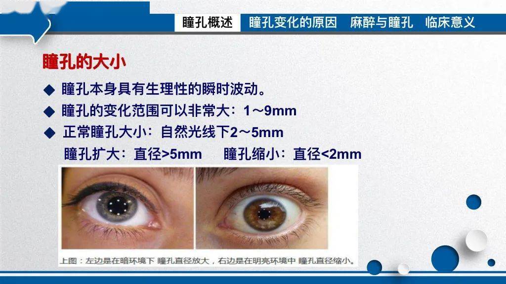 病例报告让人虚惊一场的瞳孔散大围术期瞳孔变化及临床意义
