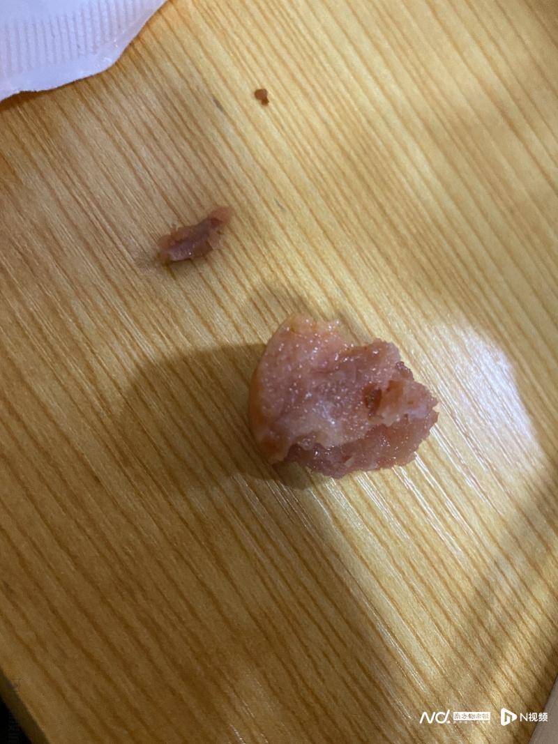 吃双汇火腿肠吃出尖锐异物，舌头被划出血？双汇称是骨头渣