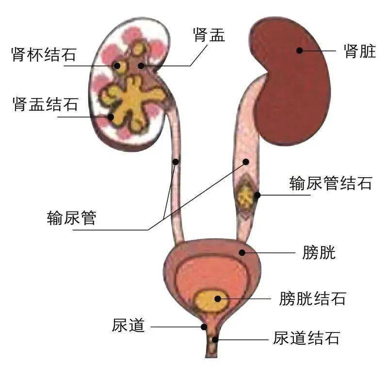 长期喝饮料