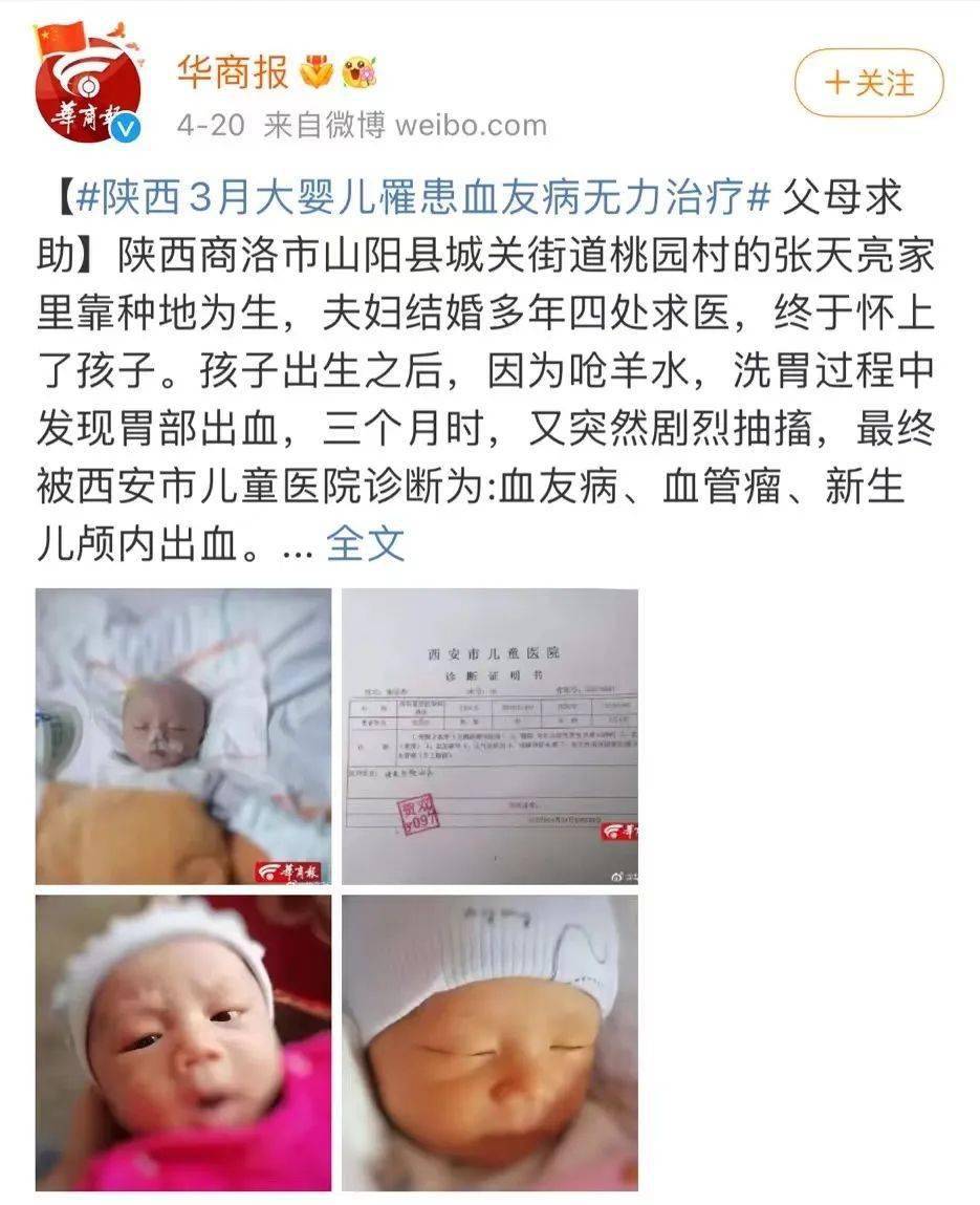 藏在欧洲皇室血统里的基因bug，竟被视为高贵的象征_搜狐网