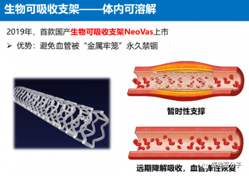 聚乳酸支架plla支架的机械强度与金属支架相近,所以可以将其直接用于