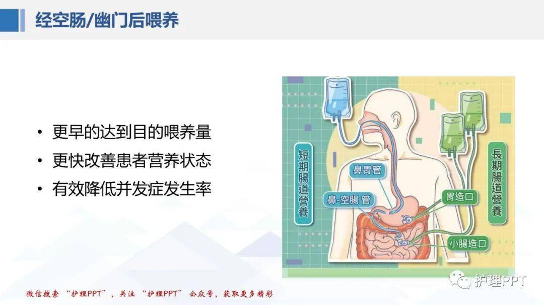 ppt鼻肠管的留置及维护