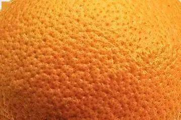 毛孔一大,皮肤就看起来很粗糙,整张脸跟个橘子皮似的,明明才二十几岁