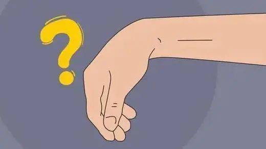 比如这位吕师傅,只出现了手腕下垂的情况.那怎么诊断桡神经损伤呢?