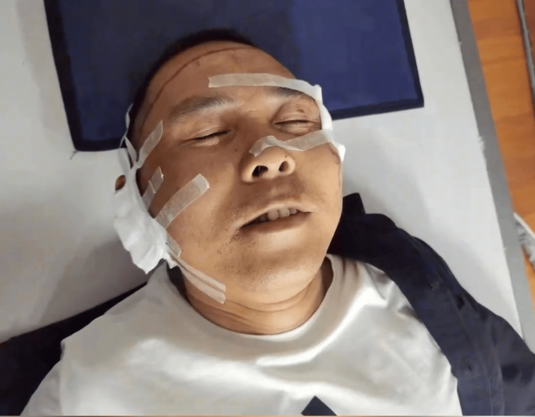 宜宾一退伍军人飞身救下两小孩,自己全身多处受伤,撕裂_王家书_孩子