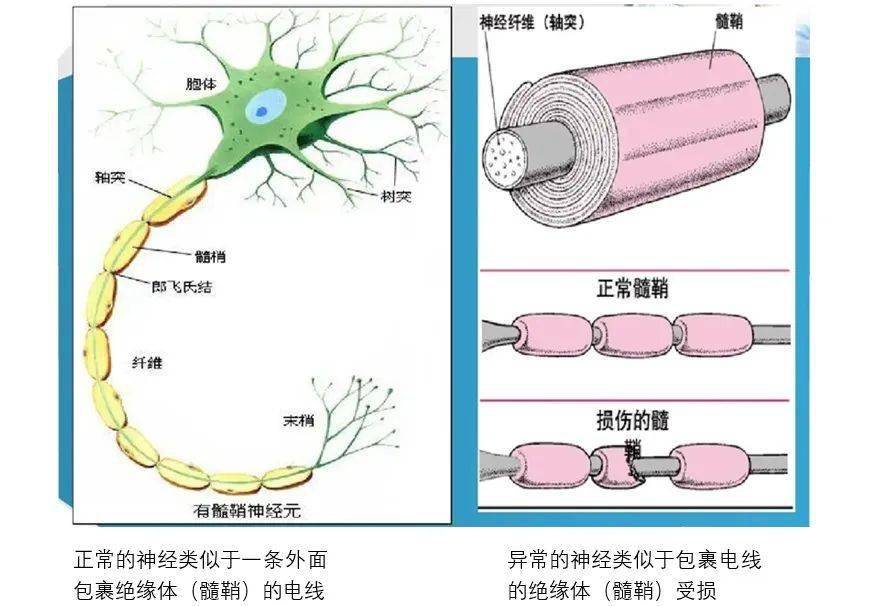 有髓神经纤维结构图图片