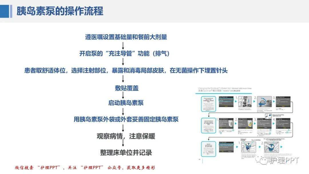 化疗泵使用图解图片