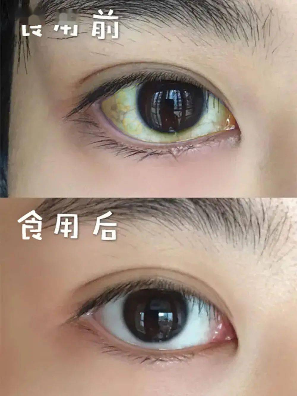 想要肝好人不老常吃这个神秘配方清肝毒降肝火