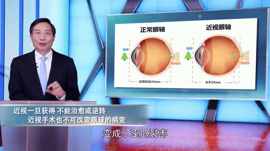 眼科专家透露“治疗近视”真相：近视手术不能治愈近视！插图