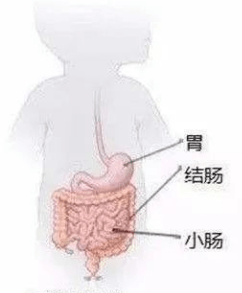 【技术分享】市妇儿医院:揪出元凶 多学科协作复位扭转肠管_手术_患儿
