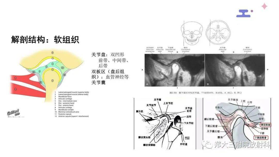 颞下颌关节紊乱的影像学表现
