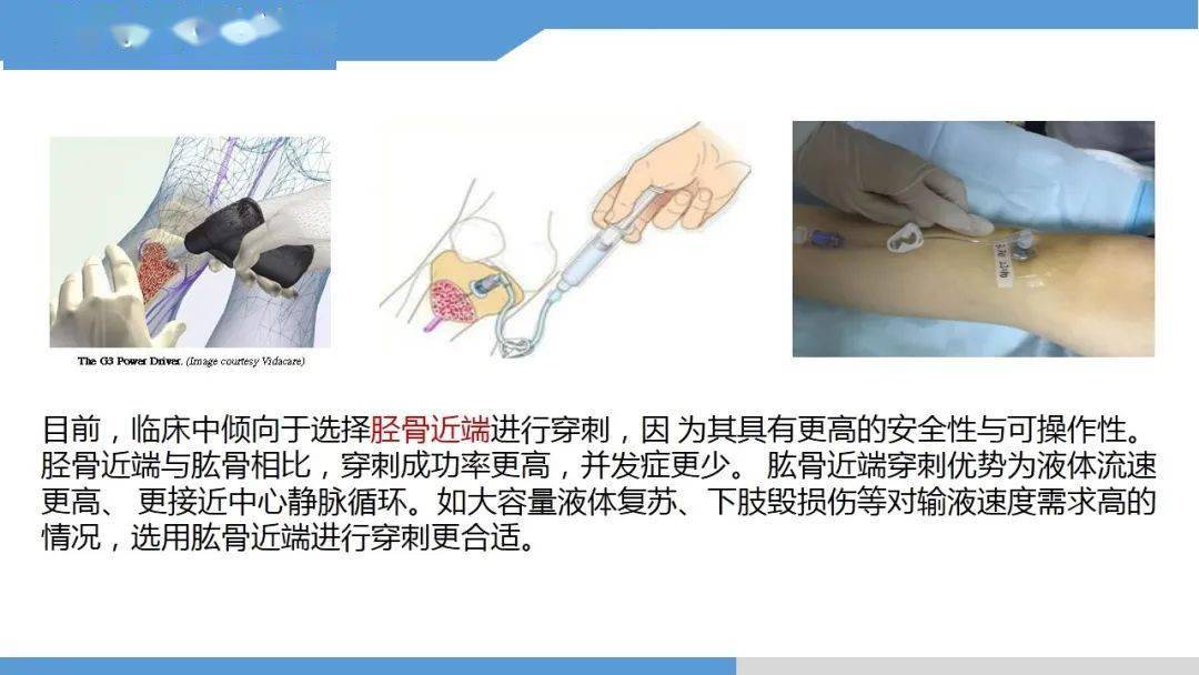 ppt永不塌陷的生命通路骨髓腔输液技术