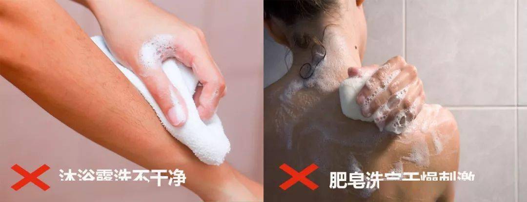 怎么长期维护鸡皮肤(多年的鸡皮肤怎么消除)