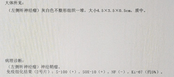 (左侧听神经瘤)神经鞘瘤病理诊断本例面神经绕行于肿瘤的上极,相对于