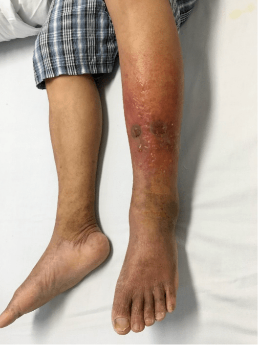 建议不要这么做……_皮肤_暴雨_细菌