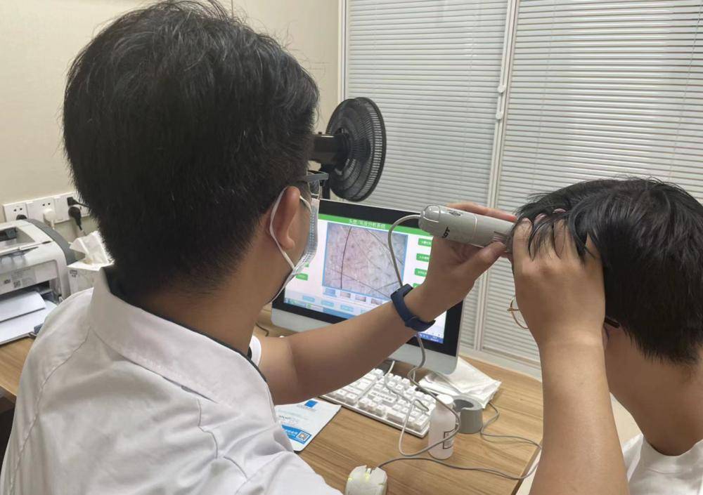 通过毛囊镜的检查,医生发现陈先生额部的头发又细又小,部分毛囊的头皮
