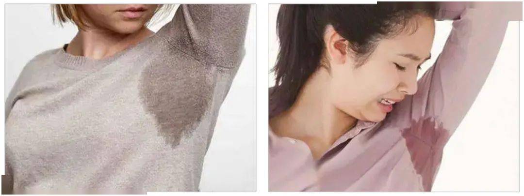 还会混合着细菌,油脂,皮屑等,形成了猛郁的恶狐臭味.