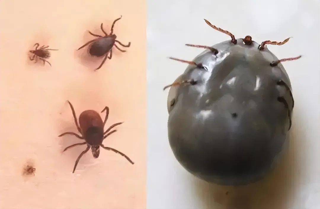 虽然并不是所有的蜱虫都可能携带病毒,但是对于抵抗力弱的宝宝来说,哪