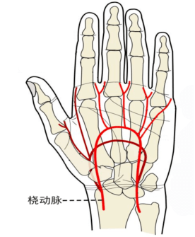 手腕大动脉位置图图片