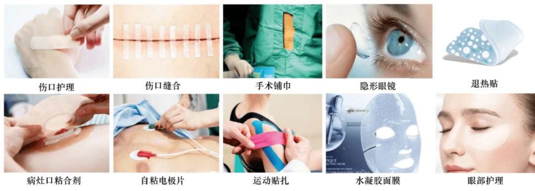 使用水胶体敷料过程图图片