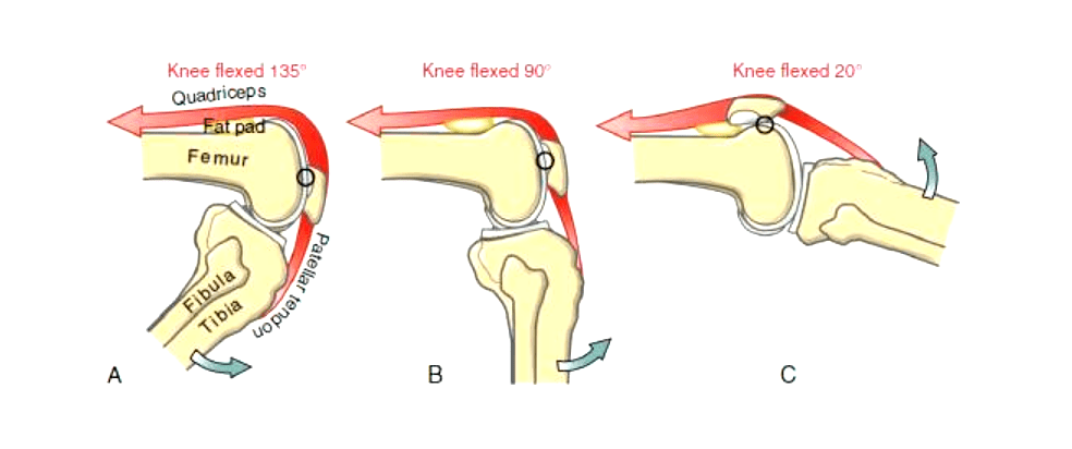 quadriceps femoris图片