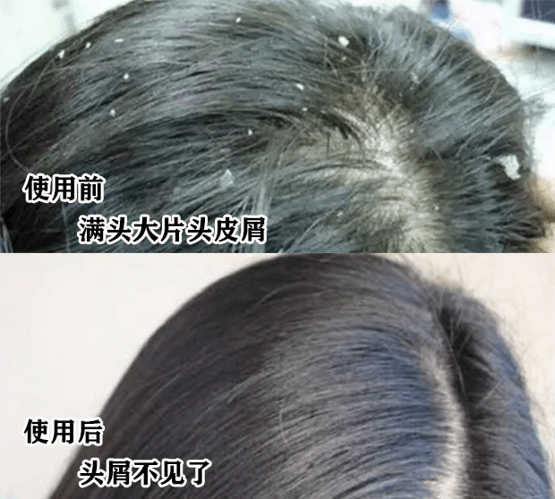“你的头发影响了你80%的颜值”：康王创始人87岁再出山，挑战5天不洗头！