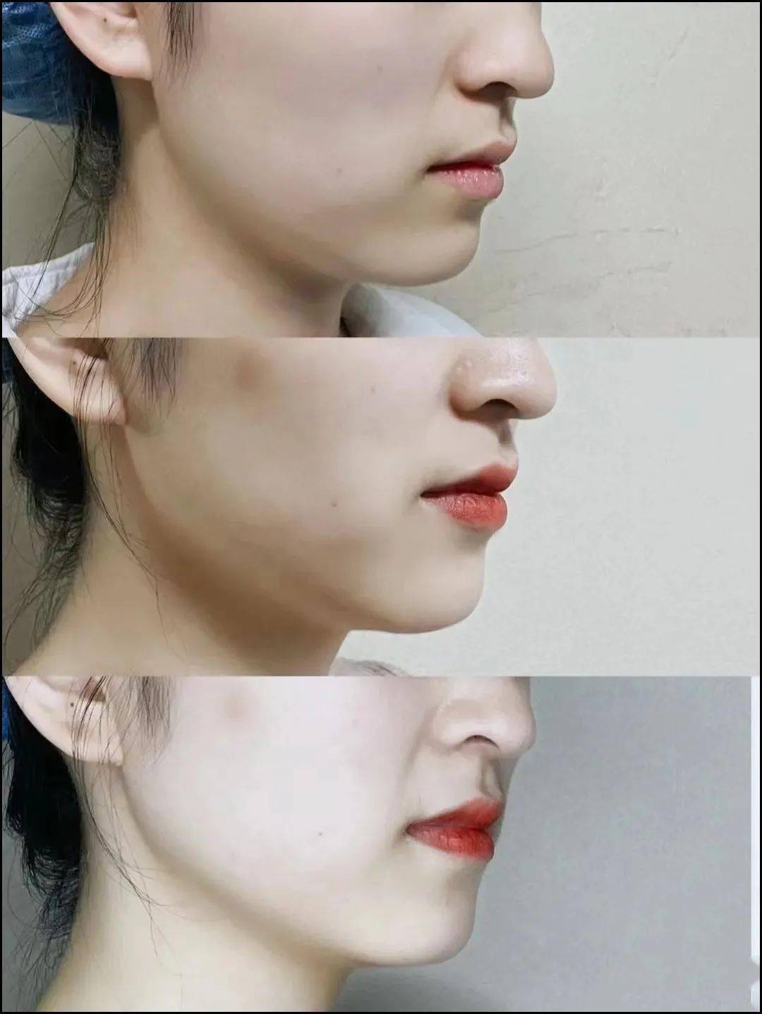 四,脸上肉不算多,但是方脸咬肌发达.