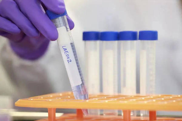 一项三药联合治疗特定实体瘤患者的Ⅰ/Ⅱ期临床研究,完成首例受试者给药_创新_安全性_需求