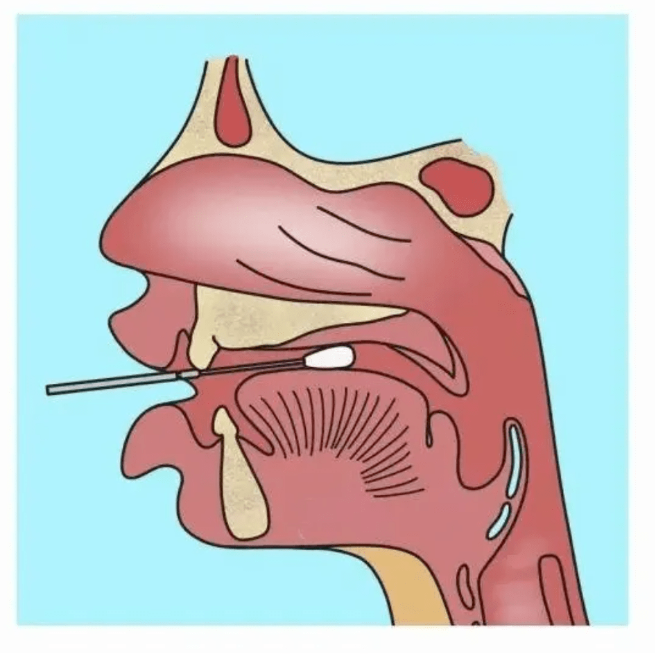 口腔核酸采样位置图片
