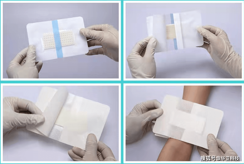 护理大讲堂 | 壳聚糖敷料为什么具有止血的功效?_创面_伤口_皮肤