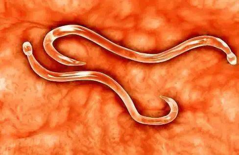 比如麦地那龙线虫会释放一种酸性物质,让人类的皮肤产生带有灼烧感的