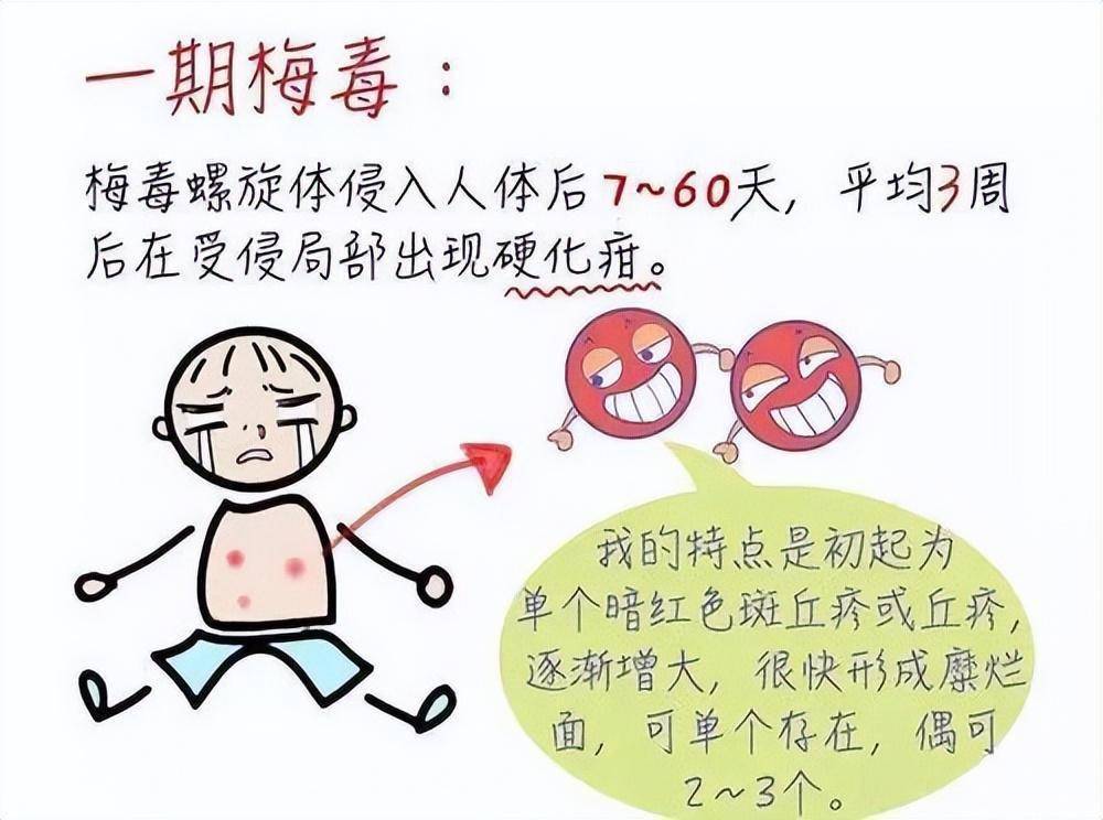 梅毒能治愈吗?建议了解一下