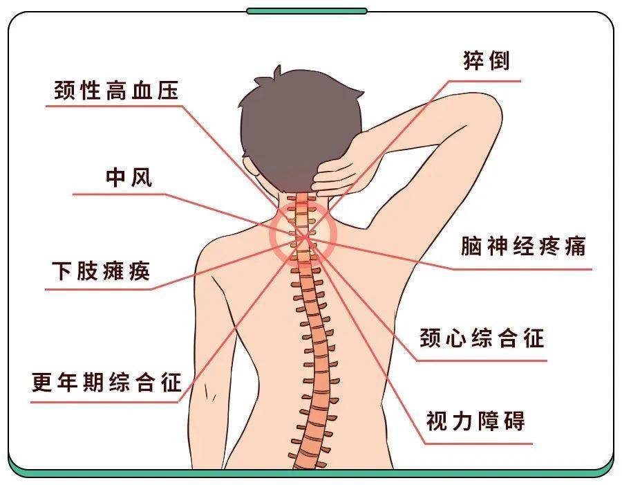 判断颈椎是否亚健康,2问+3看