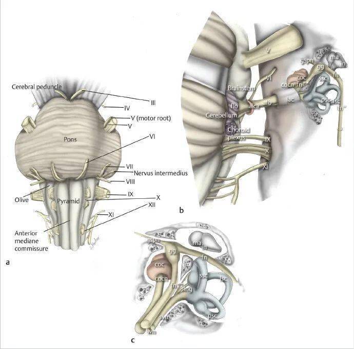 carotidartery图片