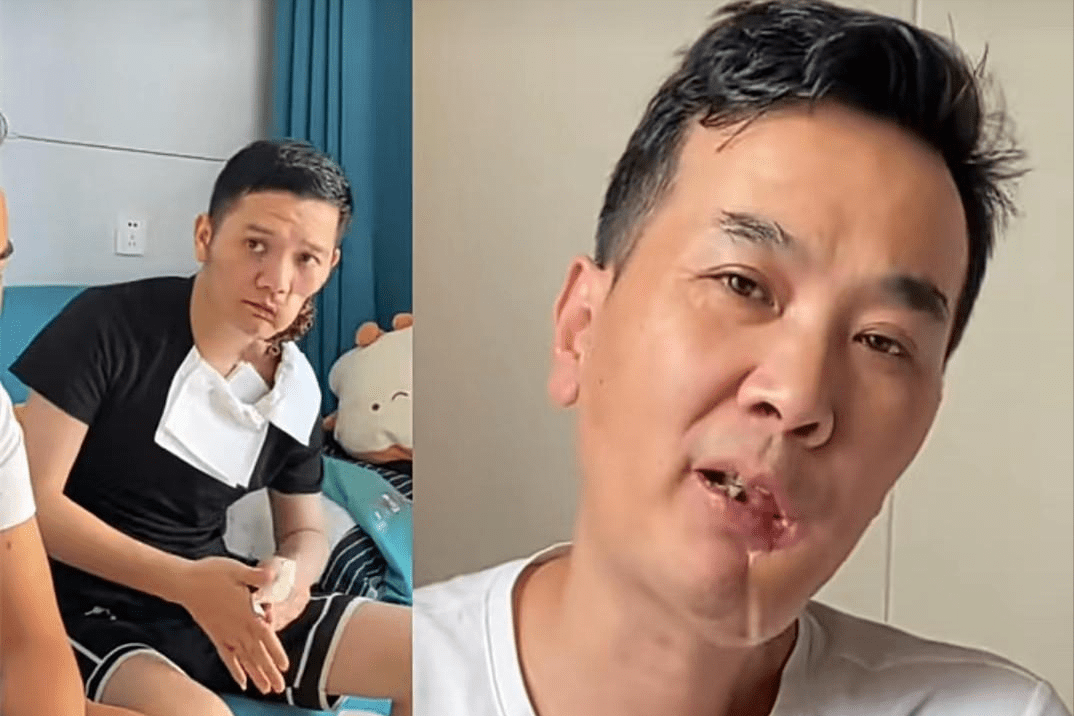 知名歌手傅松去世,嚼槟榔患上口腔癌,去世前劝网友远离槟榔_什么_东西