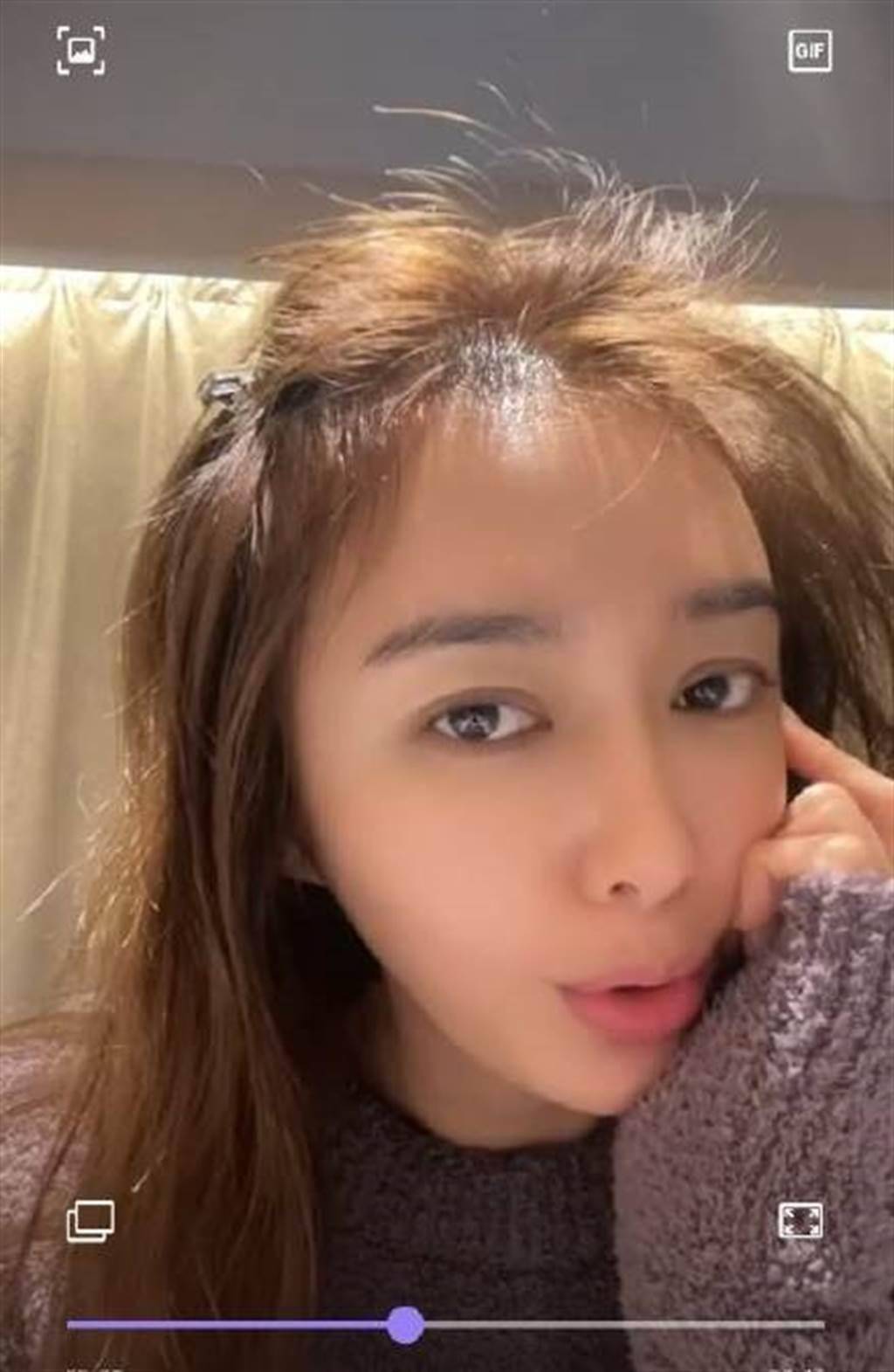 女星"秃"然的烦恼:杨幂变阿哥,秦岚头发稀疏,金晨烦恼大_沈梦辰_问题