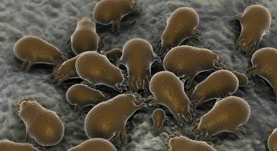 医生:螨虫正在"排便"_头皮_头发_排泄物