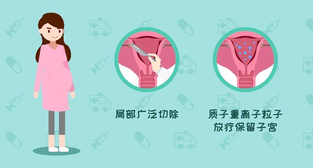 筛查_阴道_女性