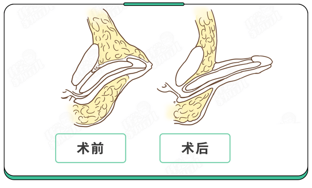 男宝丁丁多大算正常？对照0-18岁尺寸表,偏小警惕两种情况