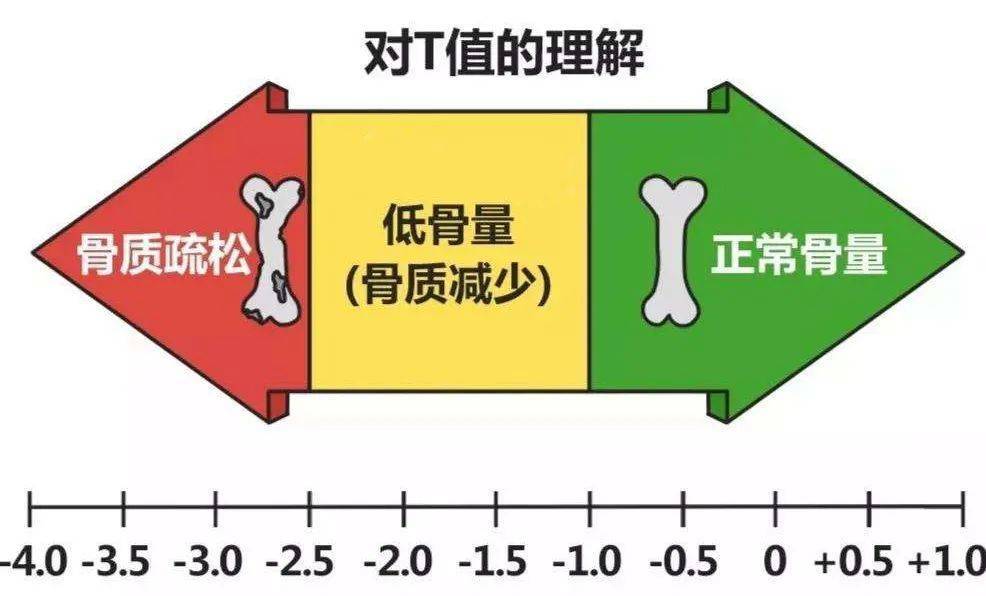 骨密度曲线图图片图片