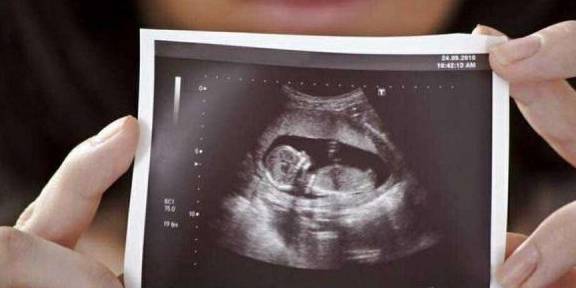 3个月的胎儿有多大图片