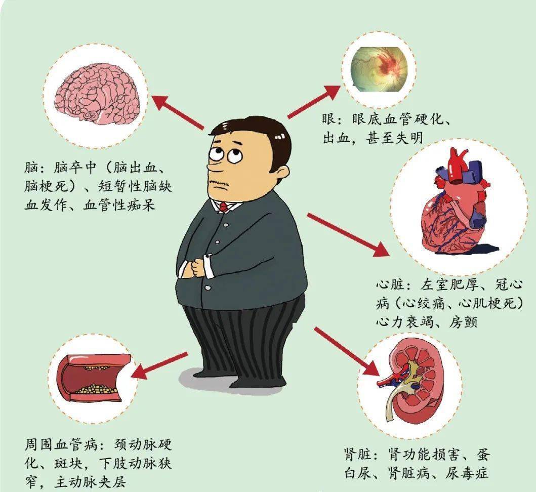 高血压分组危险因素图片