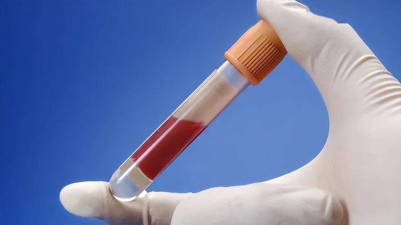 92岁陈院士,研究血脂50多年,提醒:除了肉,这3种蔬菜尽量少吃_影响