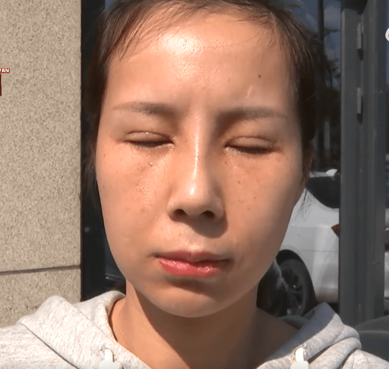女子整容后朋友称其毁容了,“又老眼睛又凹又奇怪”,当事人:根本没法见人了_女士_沟通_反馈