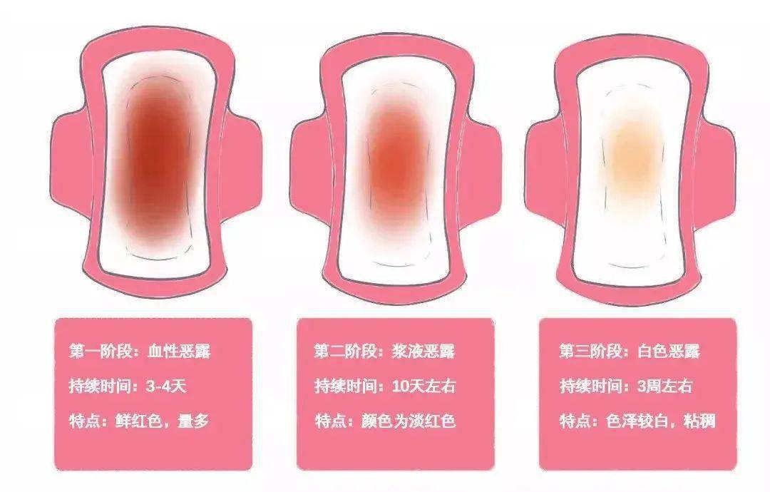 白色恶露长什么样图片