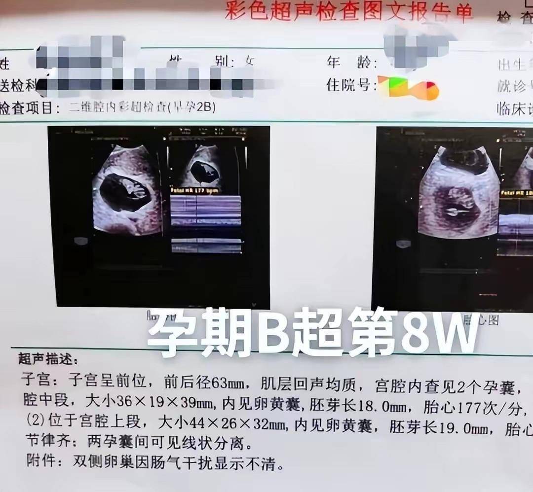 孕检报告单图片图解图片