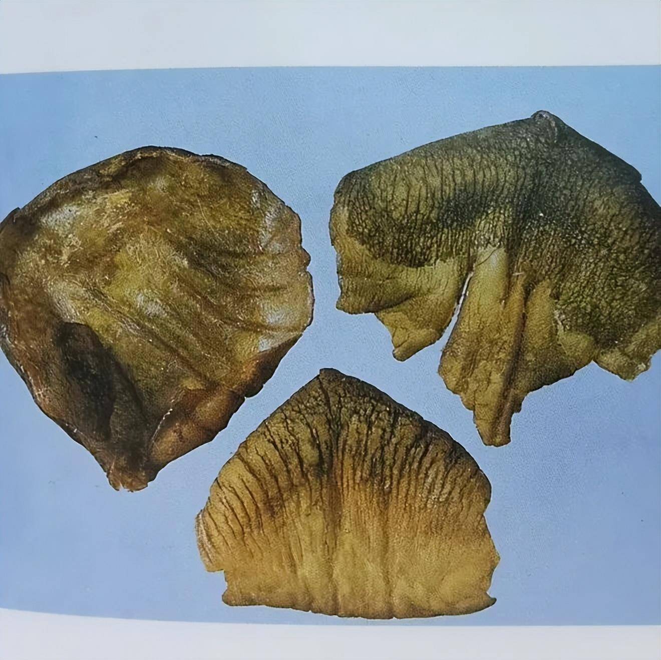 鸡内金_治疗_小儿