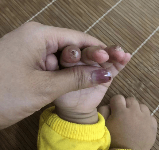 初生婴儿手指尖黑图片图片